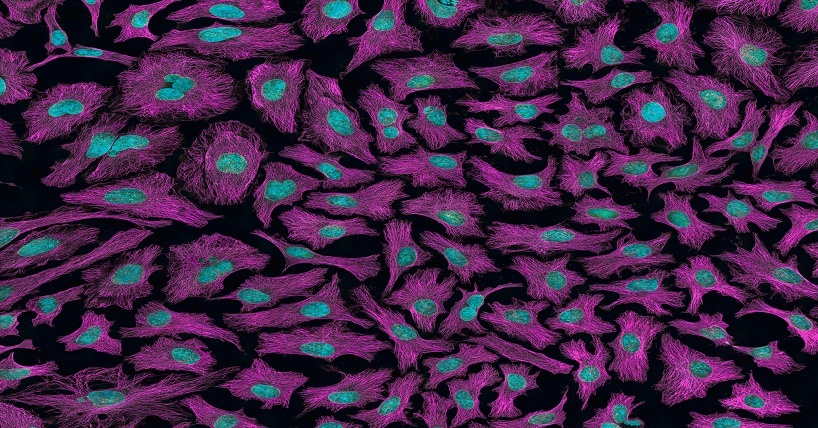 A microscopic image of purple and blue cancer cells