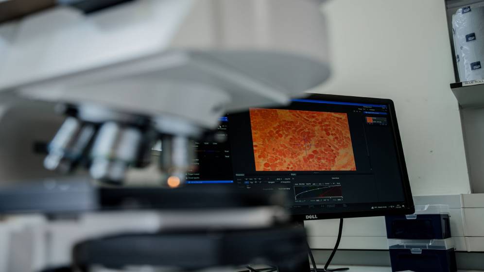 A microscope attached to a computer.